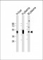 HP Antibody (Center)